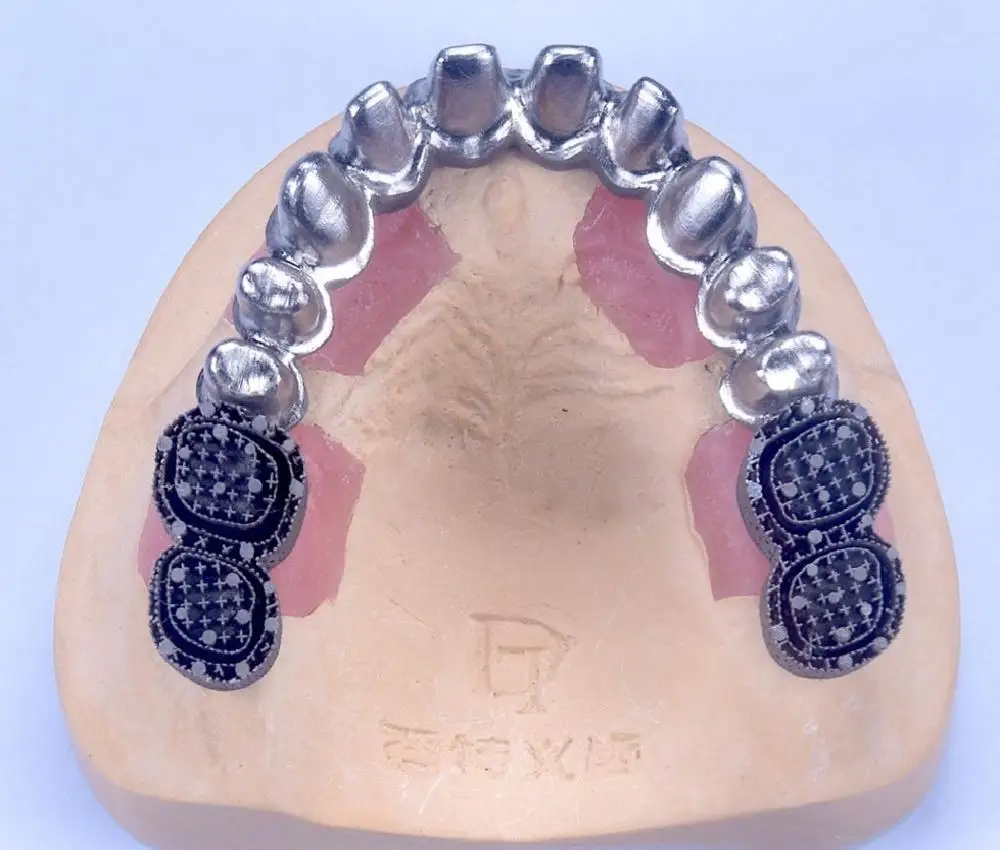 
Имплантат из титана, стоматологический имплантат, стоматологический имплантат 