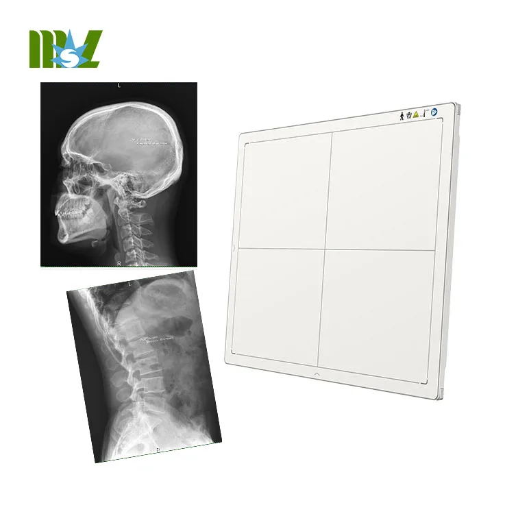 CareRay бренд Китай металлоискатель 14X17 беспроводной портативный плоский панельный рентгеновский цифровой детектор для человеческого использования MSLFP03