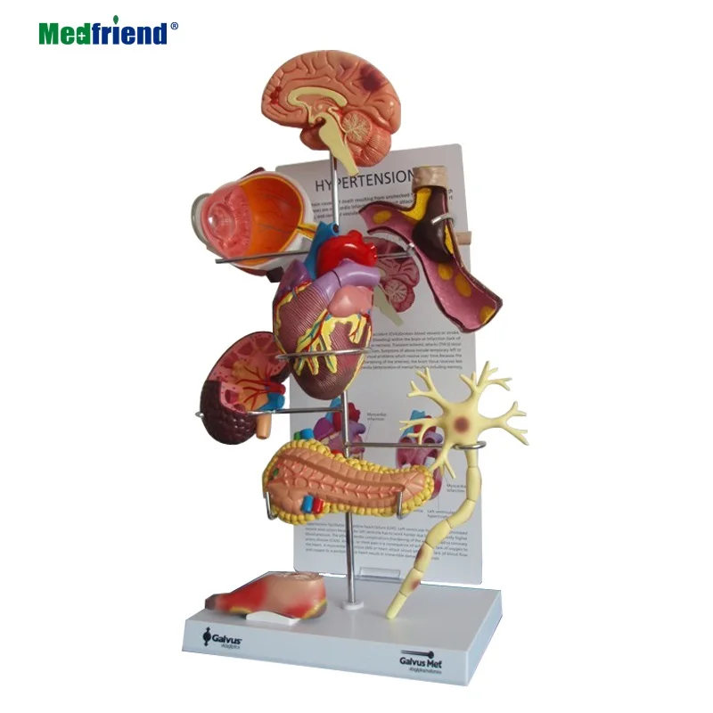 
Diabetes Type 2 Anatomical Organ Model Set- Brain, Eye, Heart, Kidney, Artery, Pancreas, Foot 
