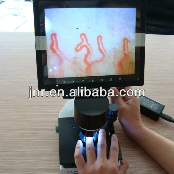 color capillary microscope Microcirculation diagnosis microscope portable clincial capillaroscope