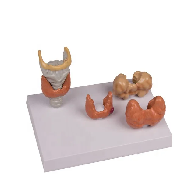 Diseased Thyroid Model Anatomical Structure Model