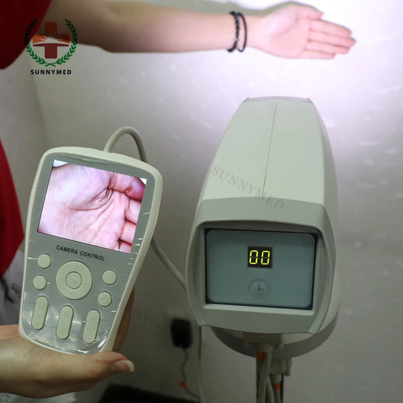 SY-F005A Gynecological Clinical Diagnostic Instruments video vagina colposcope