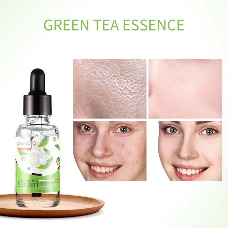 QIANSOTO High Potency Gentle Soothing Repair Skin Aloe Vera Serum 30ml
