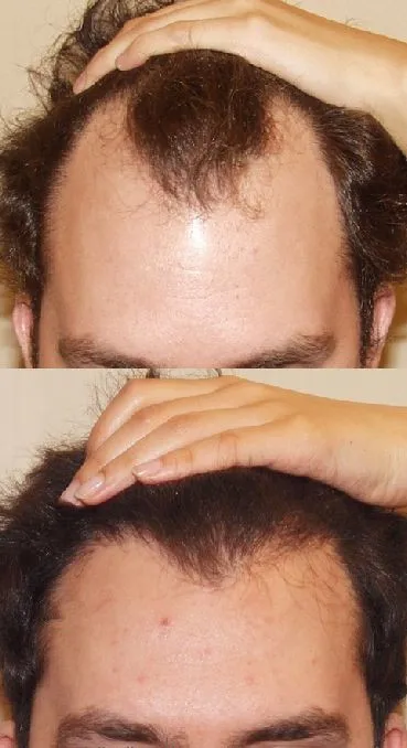 Private label professional fiber hair growth spray for thin hair