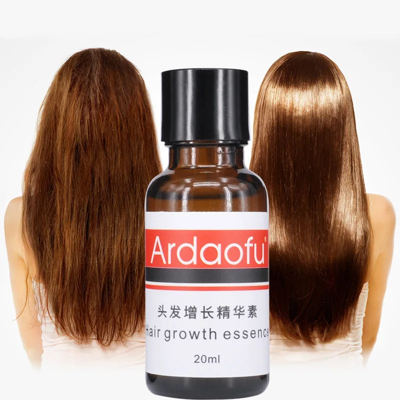 private label organic hair growth oil  serum men for hair regrowth treatment 20ml