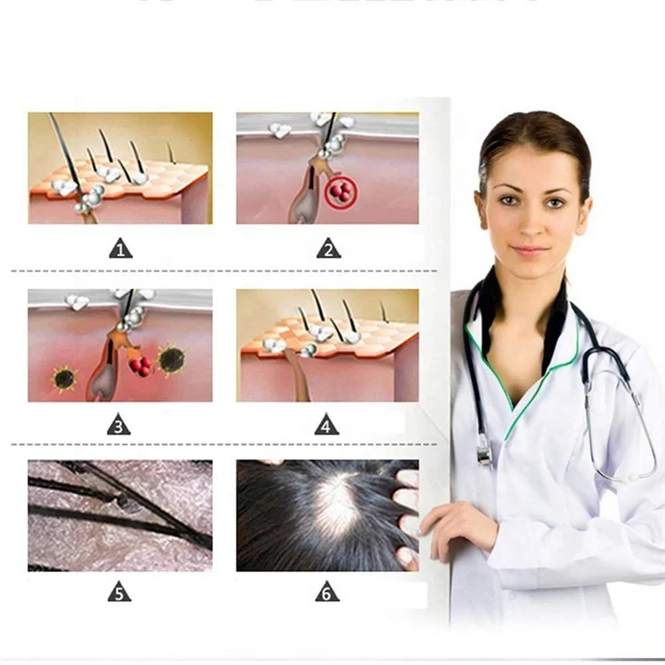 Эфирное масло для роста волос MSDS pass лечение выпадения мужчин и женщин имбирное прорастальное