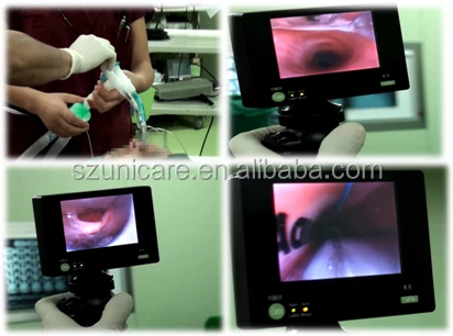 portable video flexible miller laryngoscope set endoscope Urology E.N.T Anesthesiology general surgery intubation