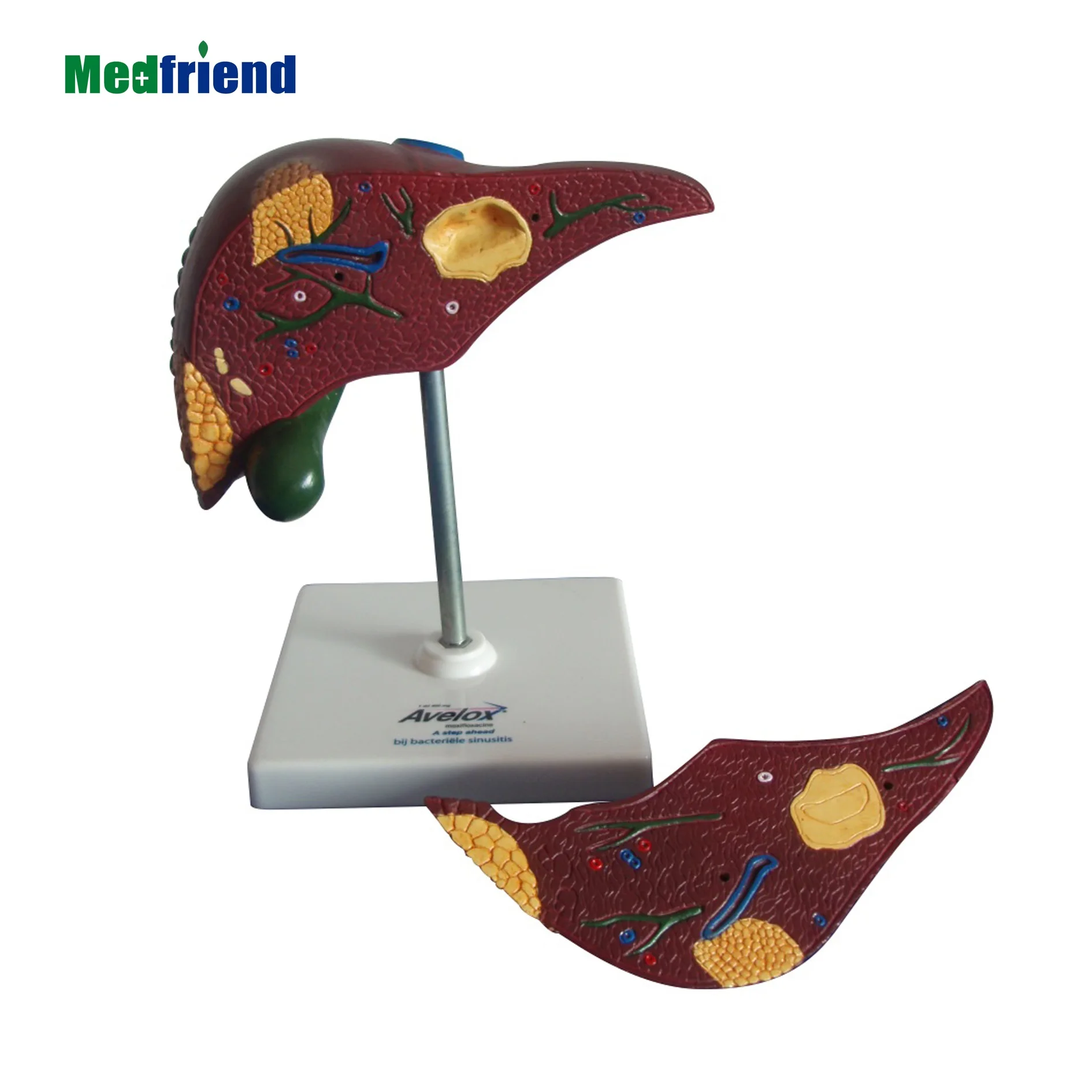
Human Liver Pathological Model Liver Cancer For School Medical Teaching Display Tool Lab Equipment 