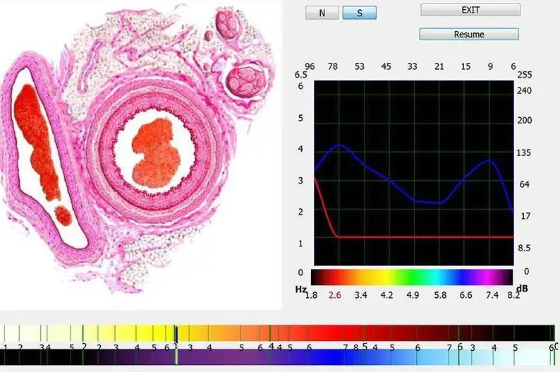 2019 9D NLS quantum resonance magnetic body bio health analyzer software price