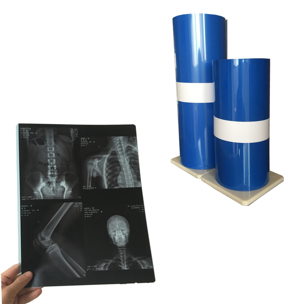 
14x17 inkjet film x ray film china producer 