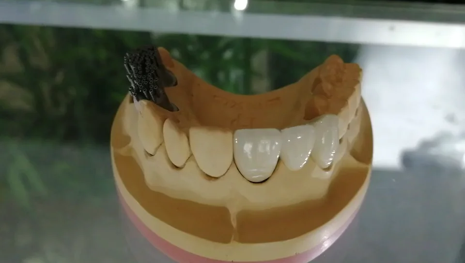 dental consumables  porcelain false teeth