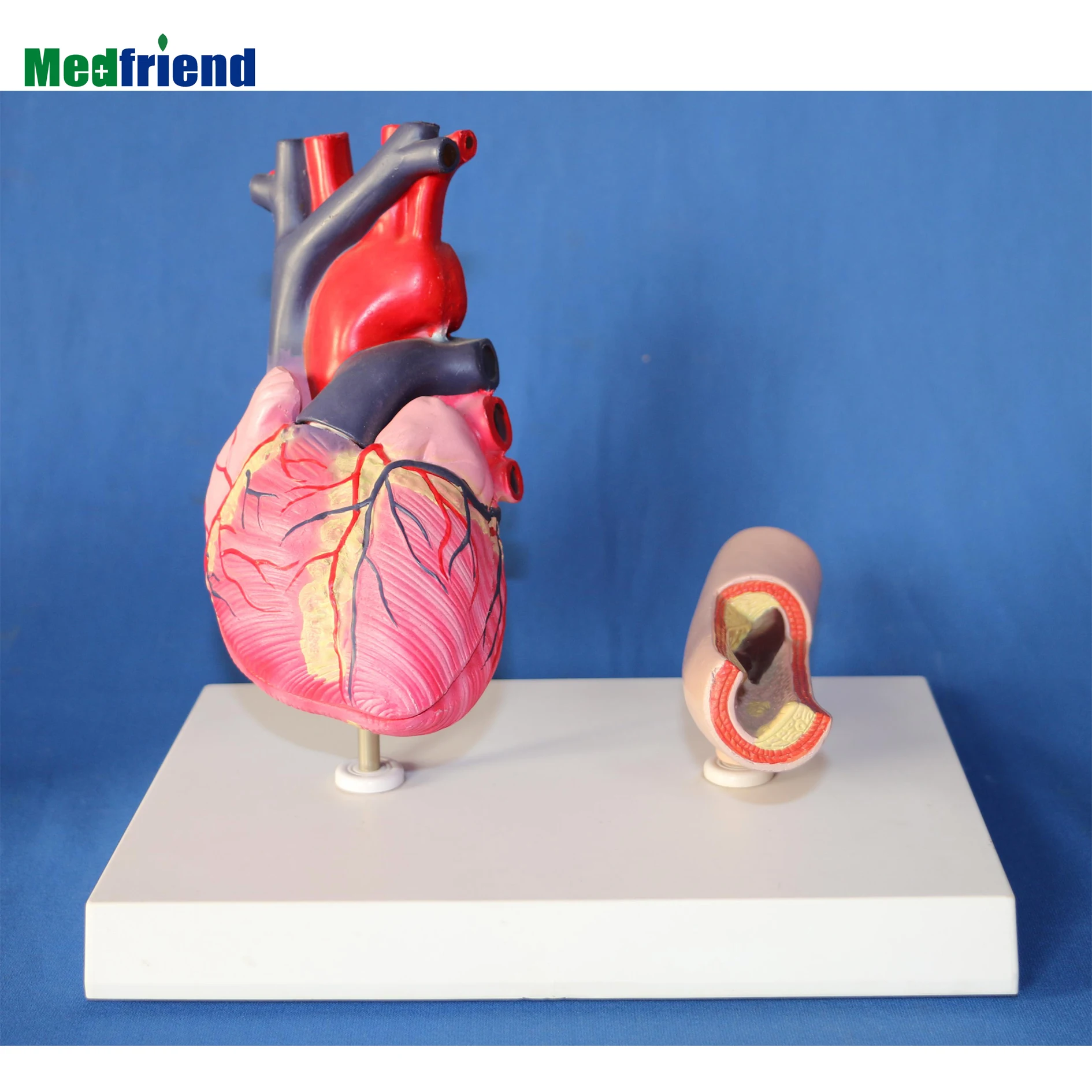 Anatomical Heart Model  Removable Human Heart Structure with Atherosclerosis Model  Anatomical Heart