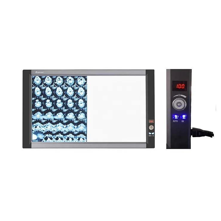 2019 Hot Sale Manufacturer Supply LED Medical X-ray Film Viewer