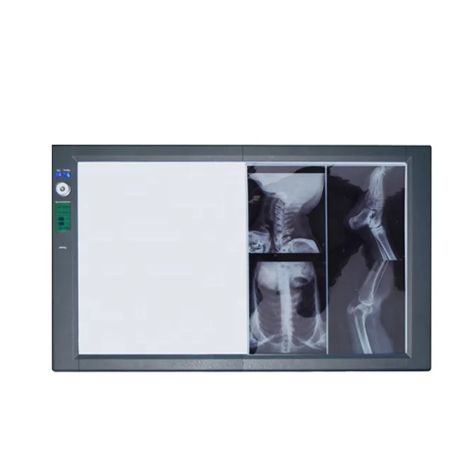 2019 Hot Sale Manufacturer Supply LED Medical X-ray Film Viewer