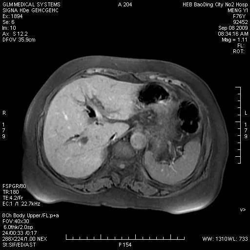 Hot sale origin Japan 8x10inch medical x-ray film Fuji DIHT  DI-HT Fuji film with Fuji thermal printer Drypix 3500 Lite 2000