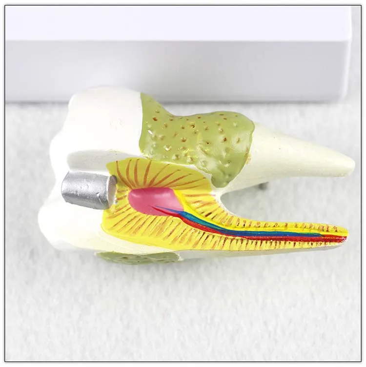 Dental Study Plastic Periodontal Teeth Human Medical Decay Common Pathologies Teeth Model