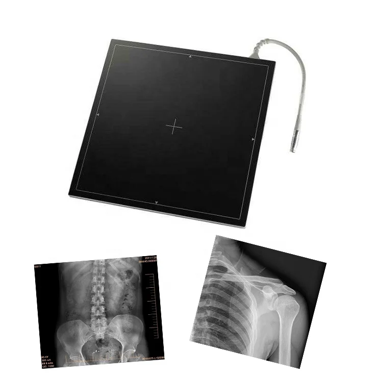 Рентгеновский детектор MSLPF01 с плоской панелью проводные цифровые детекторы низкая цена от производителя