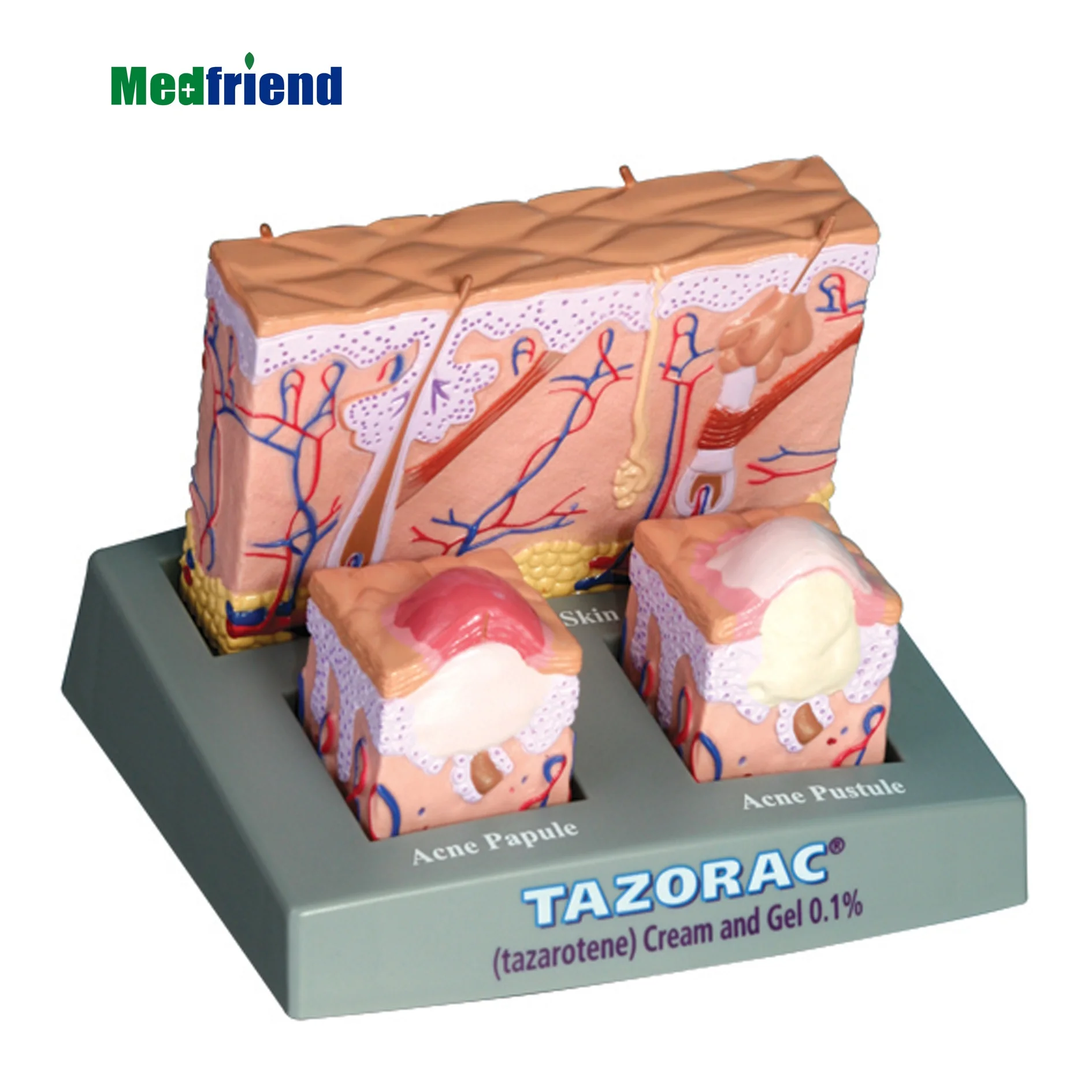 
Factory Price Advanced Anatomical Acne Skin Model 