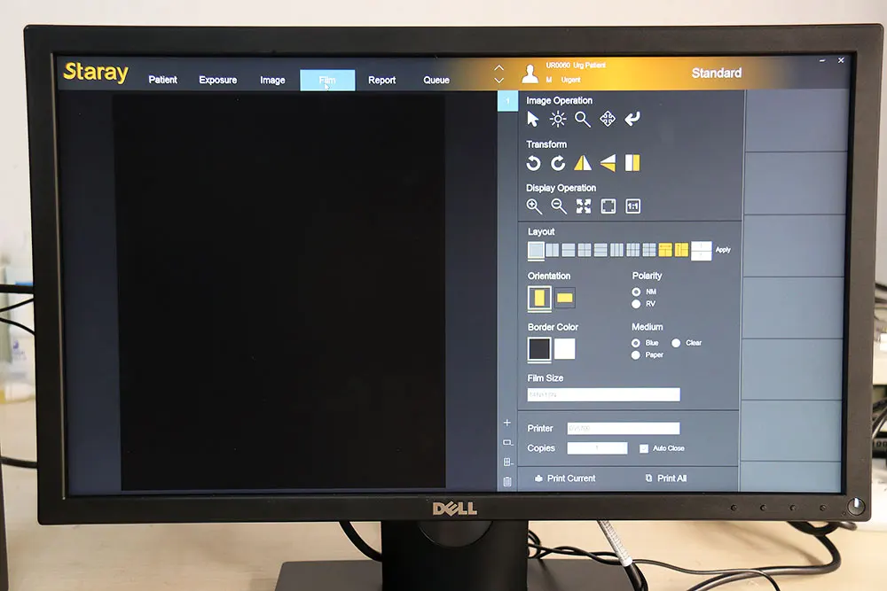 Плоский панельный детектор для цифровой радиографии CsI или GdOS