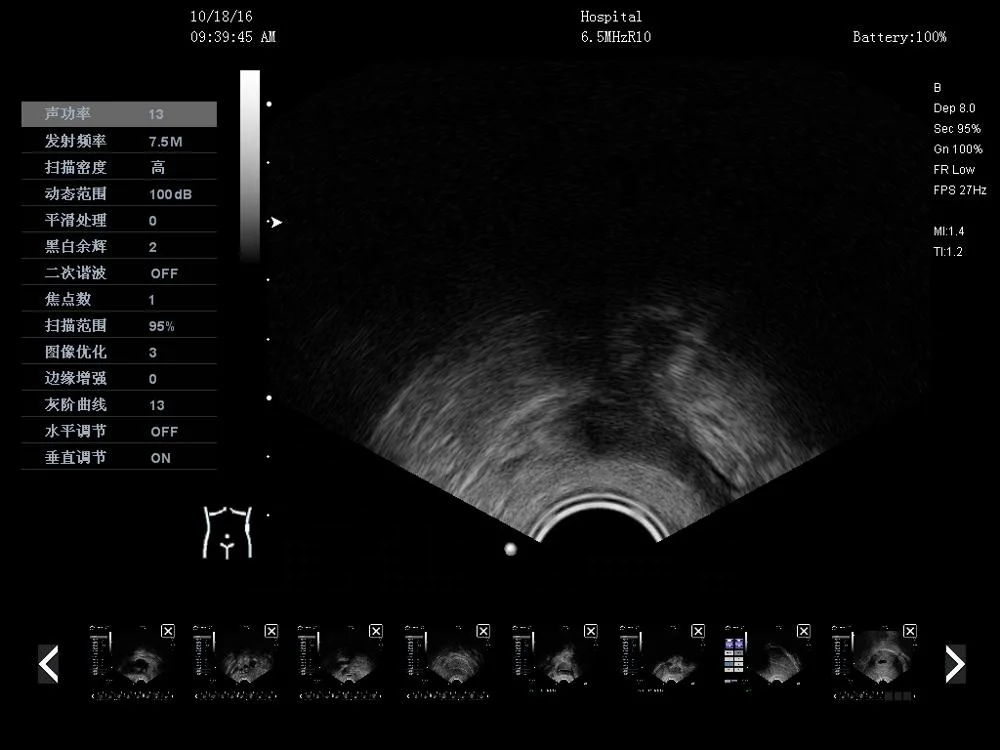 FK2 6 Languages support Portable Color Doppler Ultrasound Scanner