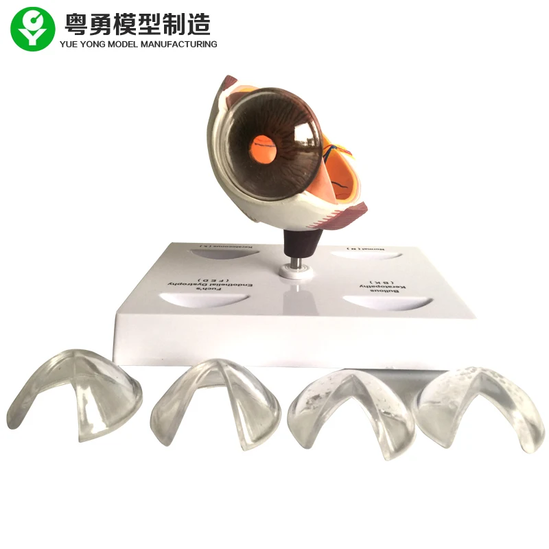 Cornea Eye Conditions Medical Anatomical Human Corneal Disease Model