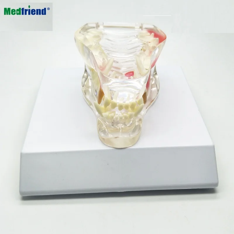 Factory Price Clear Acrylic  Canine Jaw  Teeth Model