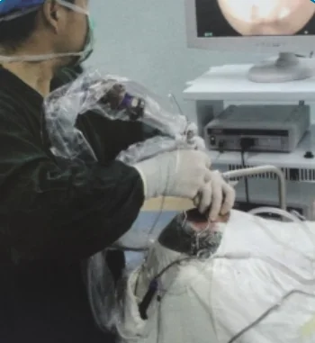 Disposable camera sleeve used surgical HD endoscopy