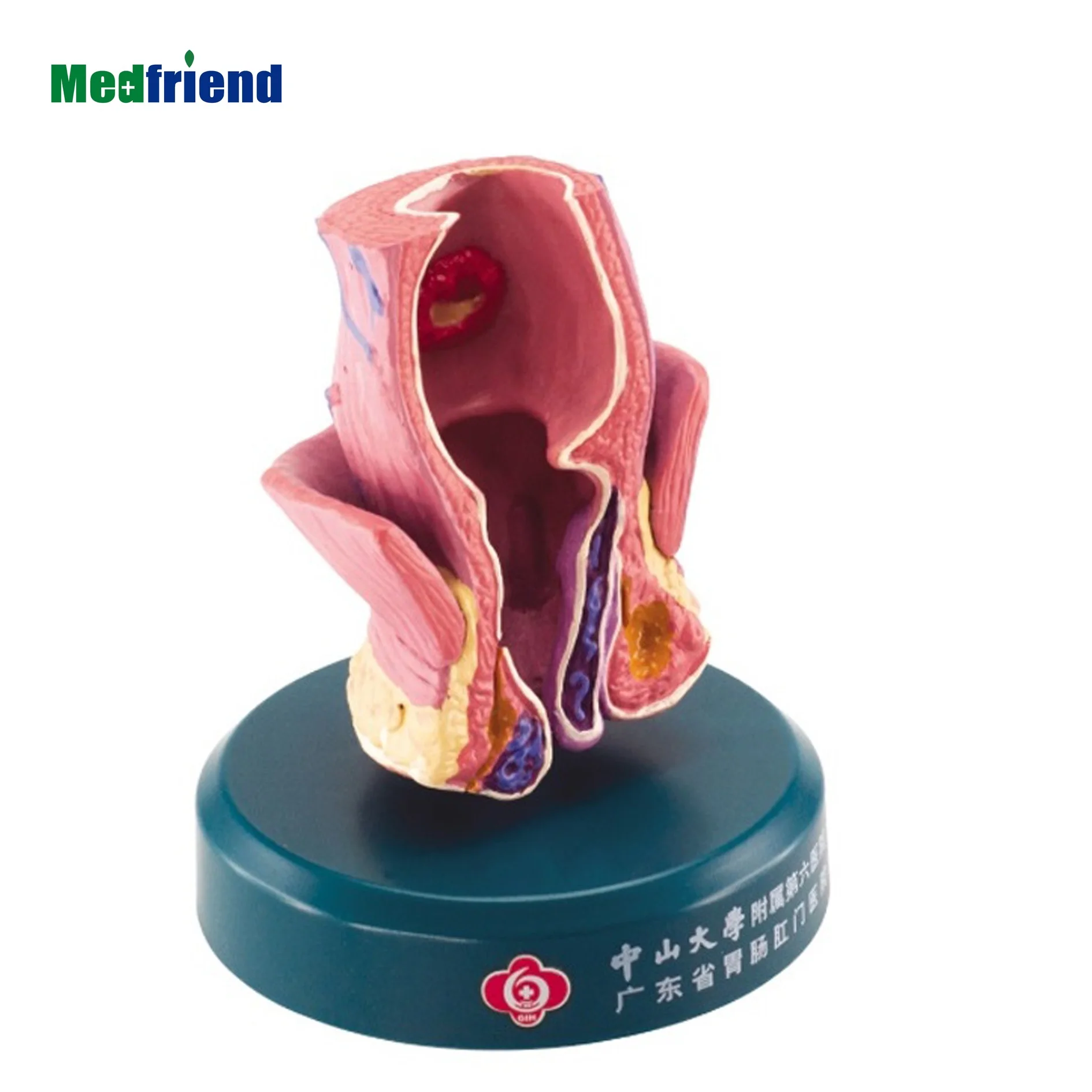 
Advanced Anatomical Model Manufacturer-- Colon-Anus & Colon Model 