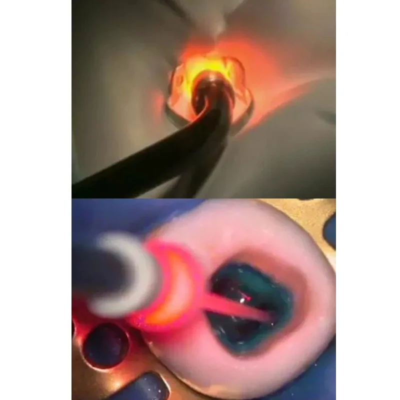 
AKsDenT F3WW Dental Diode Laser Low Level Laser therapy Photo-activated Disinfection ( PAD ) Diode Heal Laser 