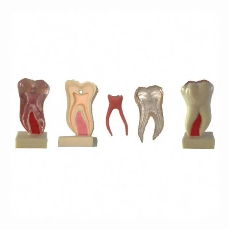 Gelsonlab HSDT-C21 6Times Anatomic Profile Teeth Model of Mandibular Molar