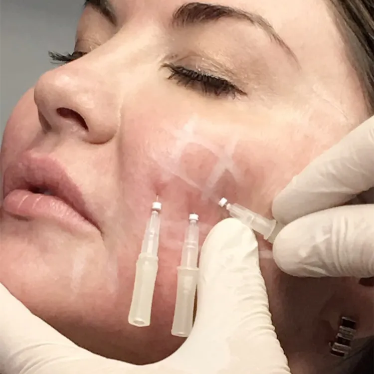 ELF LINE korean cosmetics face v-line pdo lifting thread