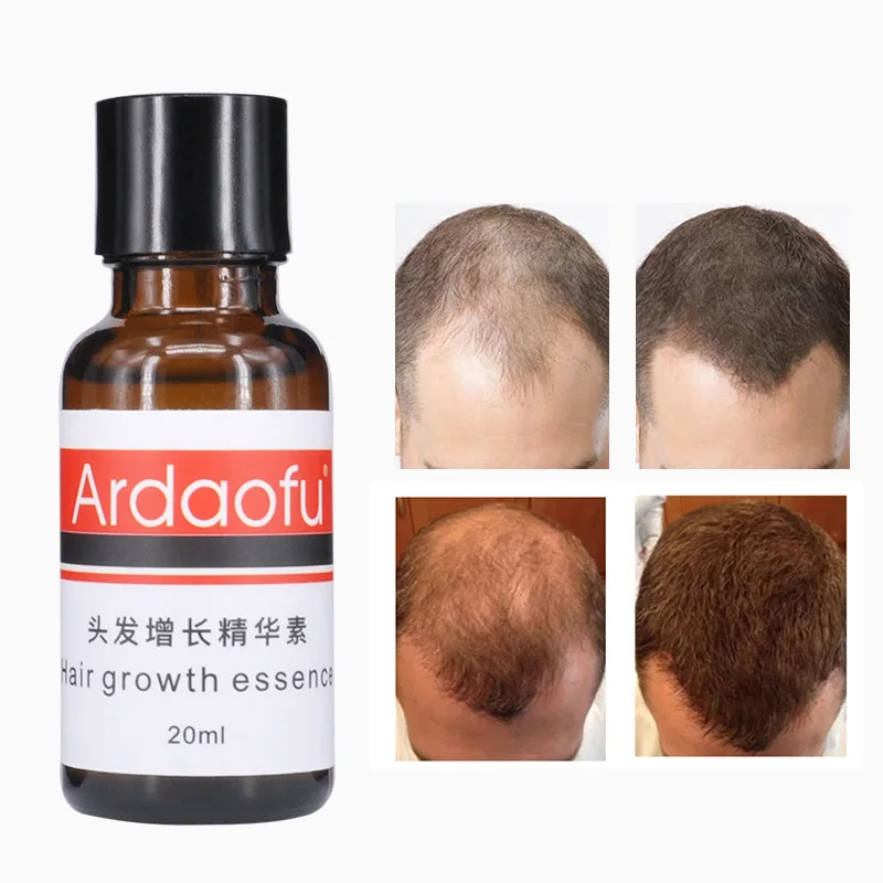 private label organic hair growth oil  serum men for hair regrowth treatment 20ml