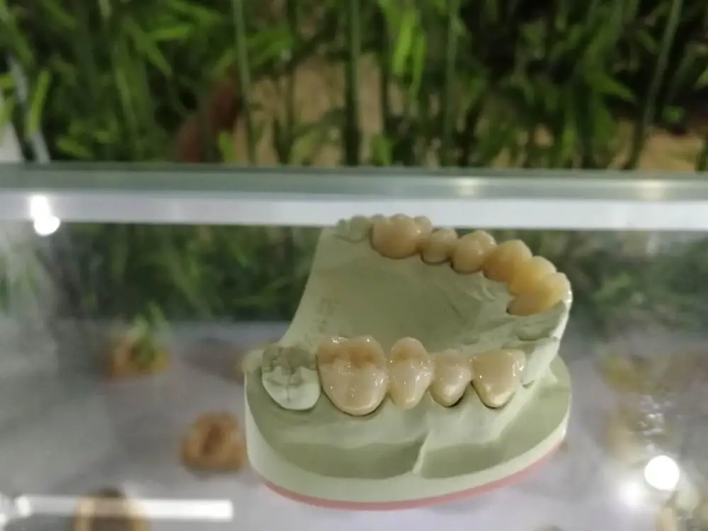 
zirconia crown zirconia teeth price dental laboratory 