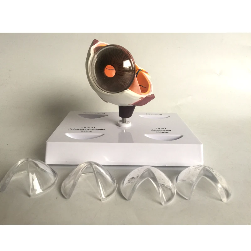 Cornea Eye Conditions Medical Anatomical Human Corneal Disease Model