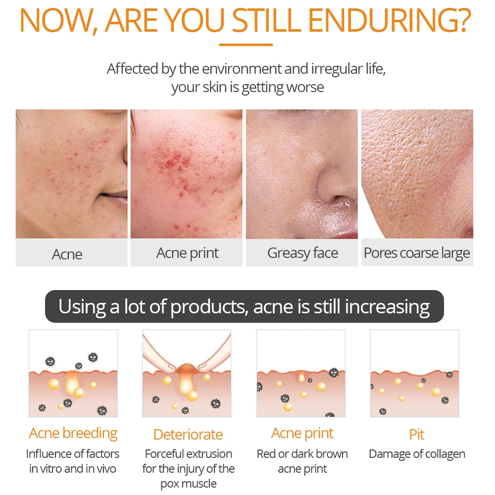 Salicylic Acid Perfecting Gel Face Mask Shrink Pores Control-oil Removing Acne Moisturizing