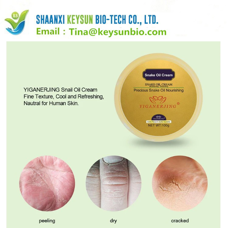 Yiganerjing змея масла паракват крем
