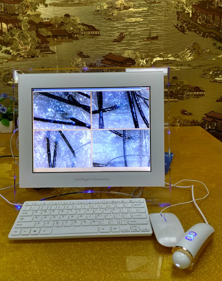 Professional visia skin analyzer 3d magic mirror skin analyzer