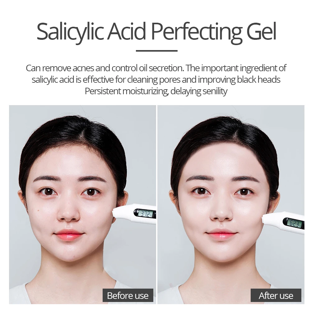 Salicylic Acid Perfecting Gel Face Mask Shrink Pores Control-oil Removing Acne Moisturizing