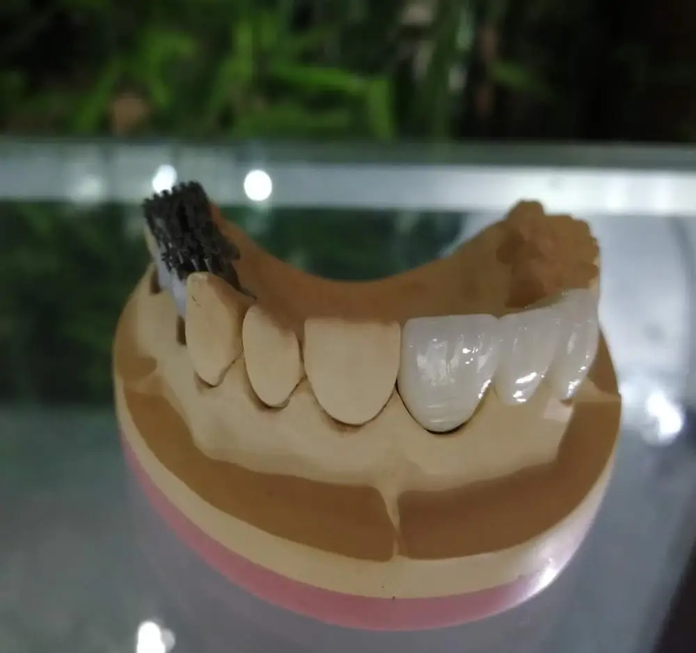 dental consumables  porcelain false teeth