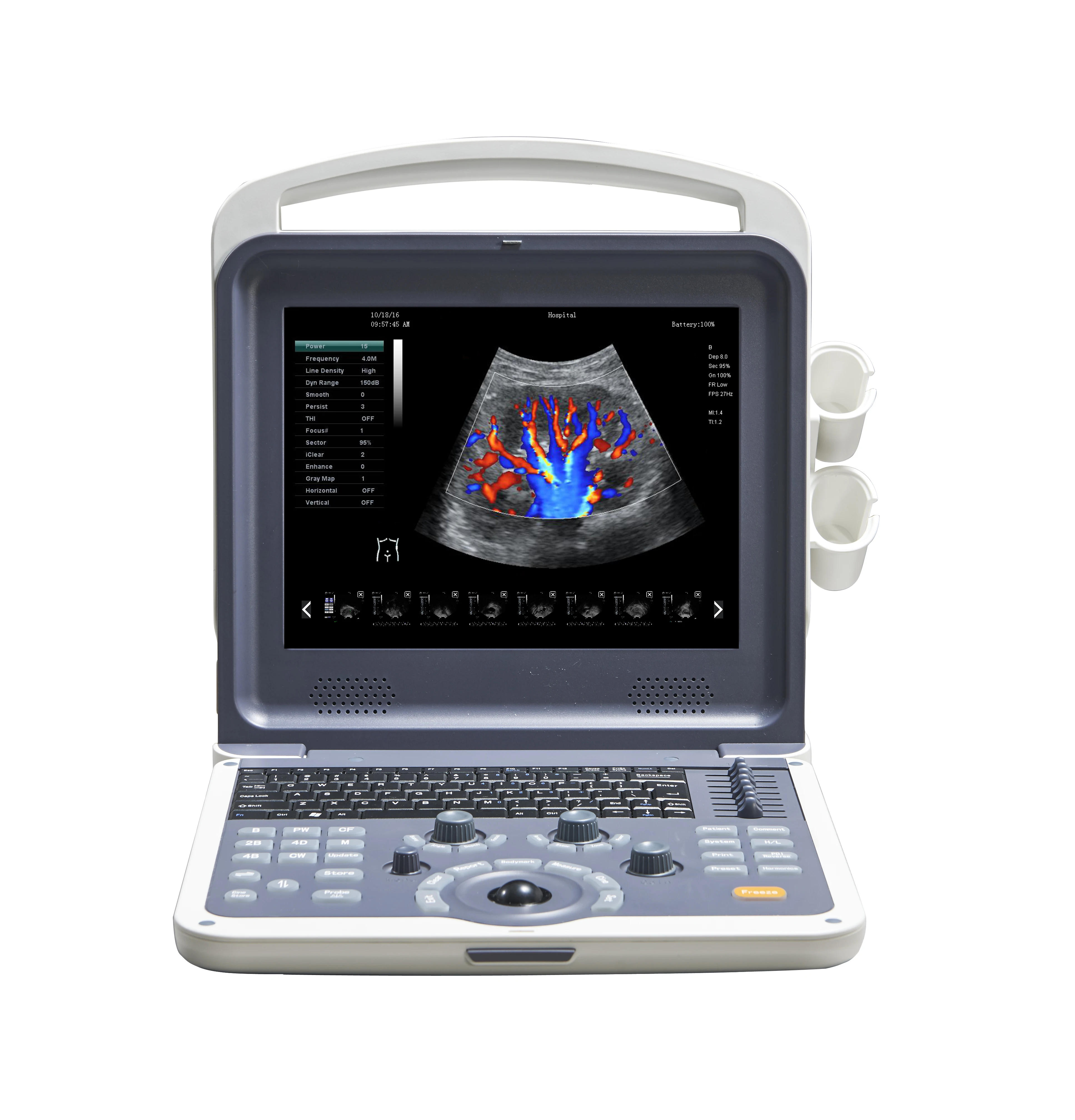 FK2 6 Languages support Portable Color Doppler Ultrasound Scanner
