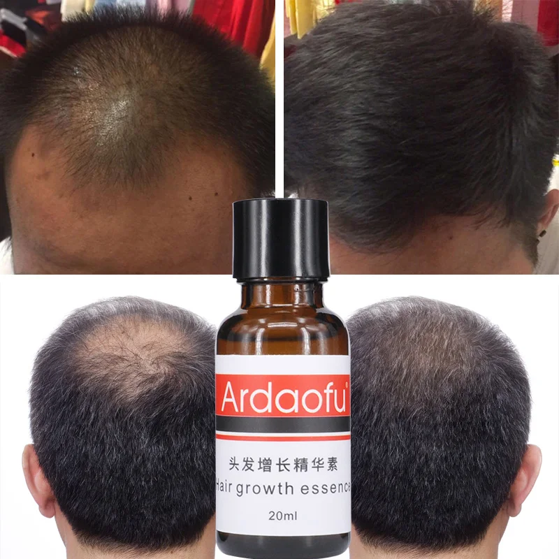 private label organic hair growth oil  serum men for hair regrowth treatment 20ml