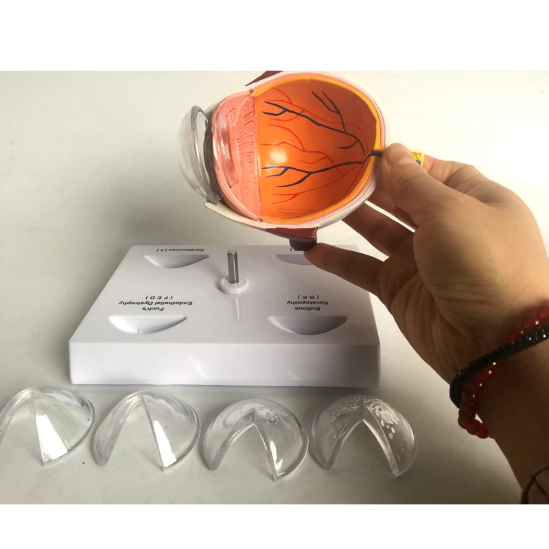 Cornea Eye Conditions Medical Anatomical Human Corneal Disease Model