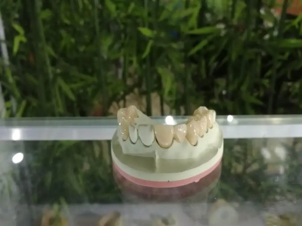 
zirconia crown zirconia teeth price dental laboratory 