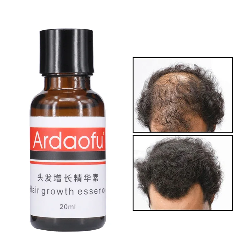 private label organic hair growth oil  serum men for hair regrowth treatment 20ml