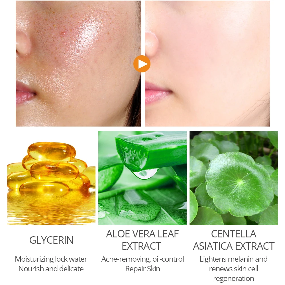 Salicylic Acid Perfecting Gel Face Mask Shrink Pores Control-oil Removing Acne Moisturizing