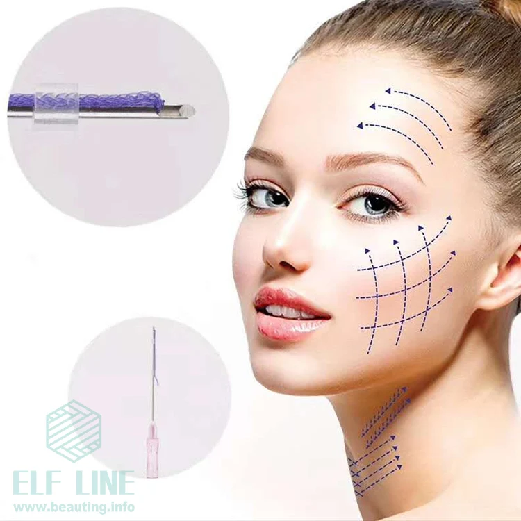 2021 Korea fox eye V Line Medical Korea PDO/PCL/PLLA Face Thread Lift with High Quality