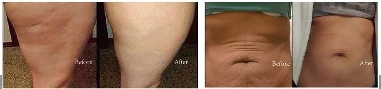 100% Natural Fat Burning Product Private Label Hot Cream Slimming  Cellulite Cream
