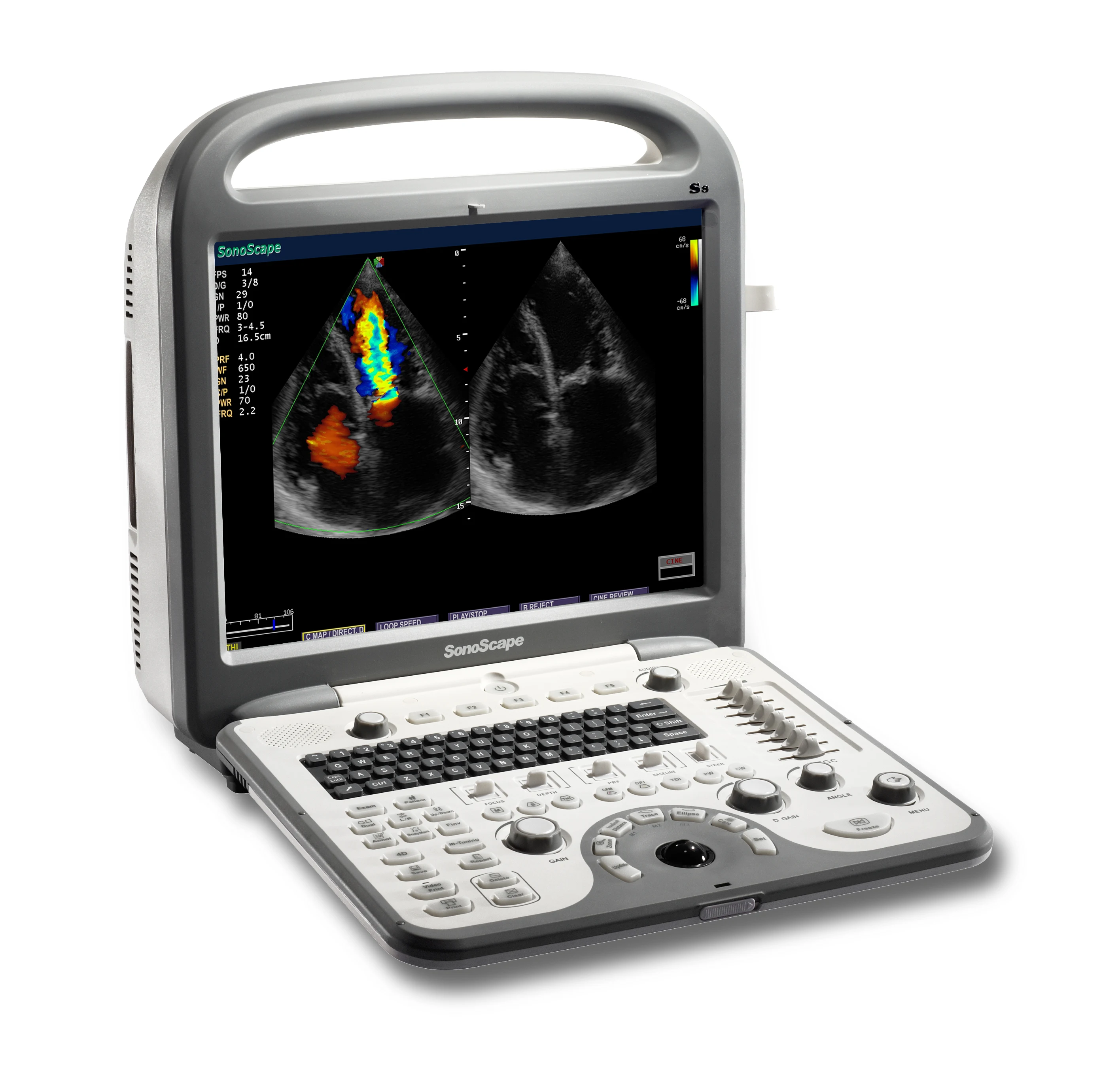 2019 Advanced Technology 4D Imaging sonoscape s8 portable ultrasound machine