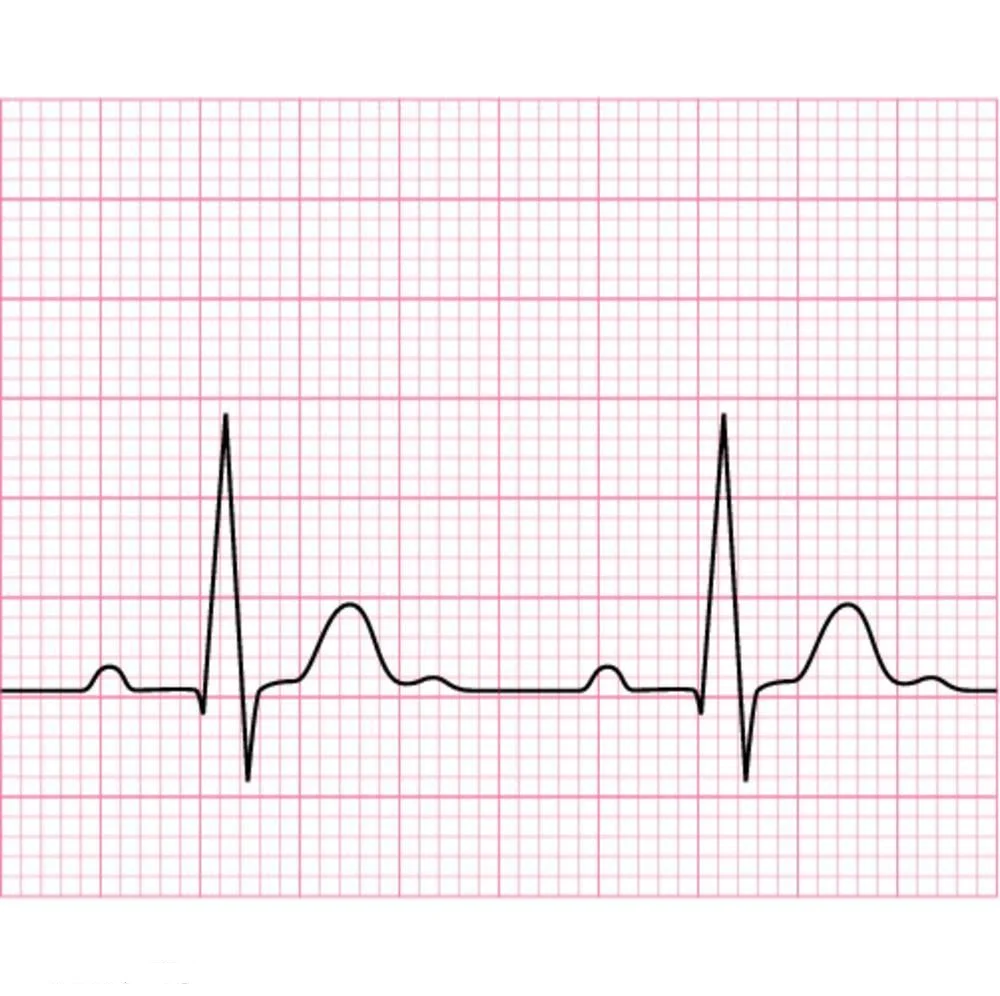 EDAN GE MAC 5000 MA1200 ECG THERMAL PAPER