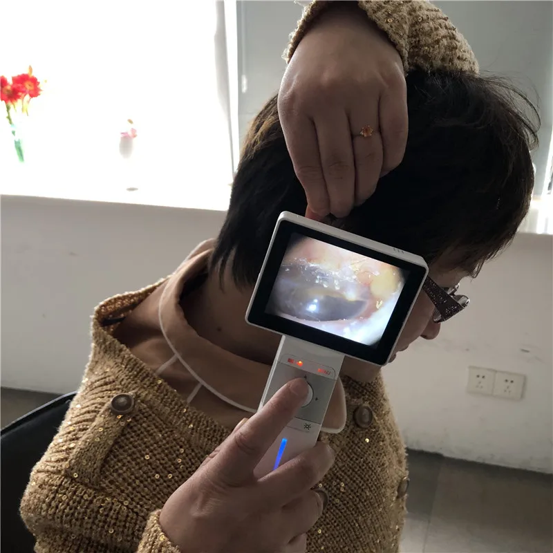 3.5 inch Color Screen Otoscope Endoscope Parts Handheld ENT Inspection Equipment With CE Certificate